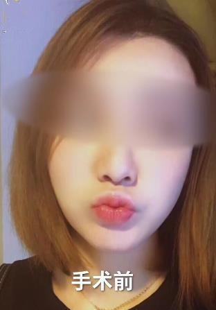 女主播整容侧脸