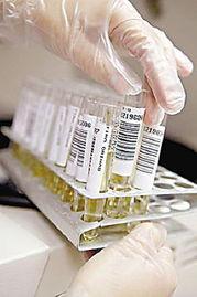 尿红的照片,从照片看健康信号