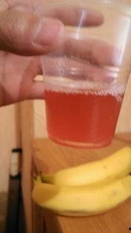 尿红的照片,从照片看健康信号