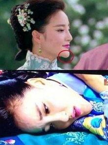 刘雨欣整容前照片下巴,刘雨欣整容前后下巴蜕变记